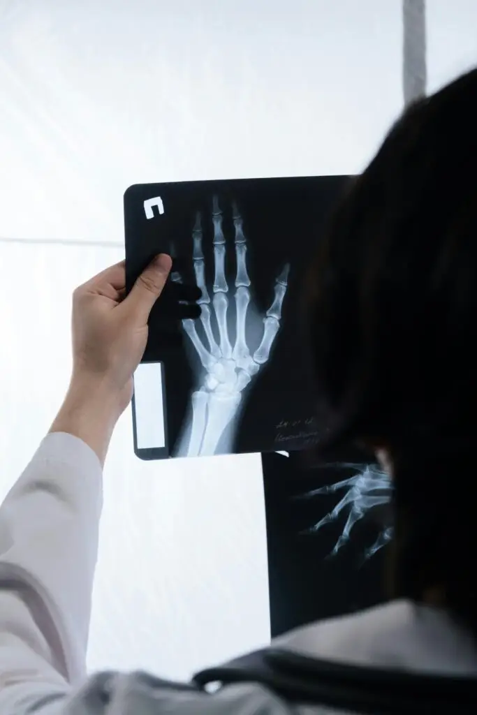 Doctor analyzing hand X-ray for signs of injury or bone health evaluation.