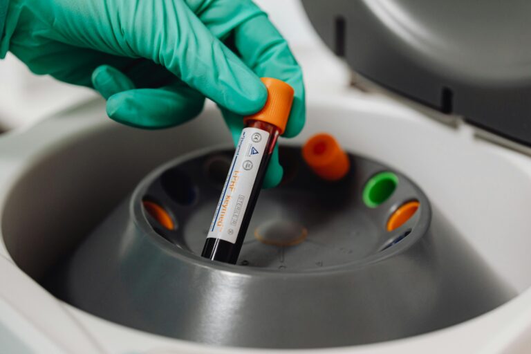 A medical professional holds a blood vial ready for centrifuge in a lab setting.